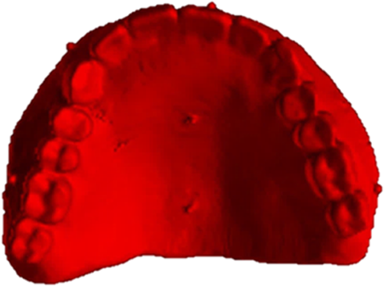 Using the surgical guide for impressionfree digital bite registration in the edentulous maxilla