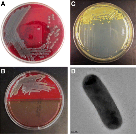 insights from the draft genome into the pathogenicity of a elizabethkingia meningoseptica