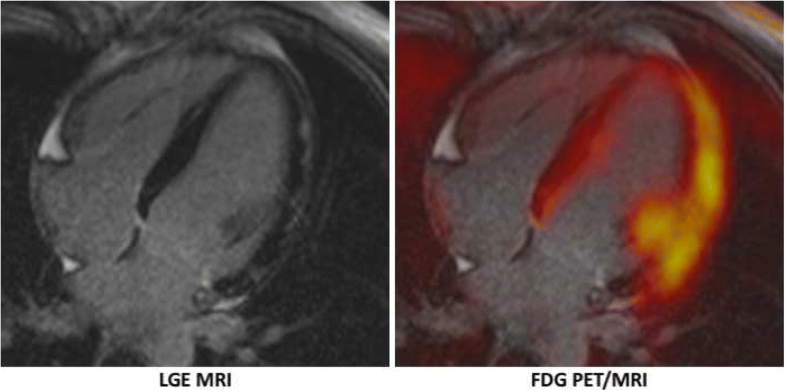 Cardiac PET/MRI—an update | European Journal of Hybrid Imaging | Full Text