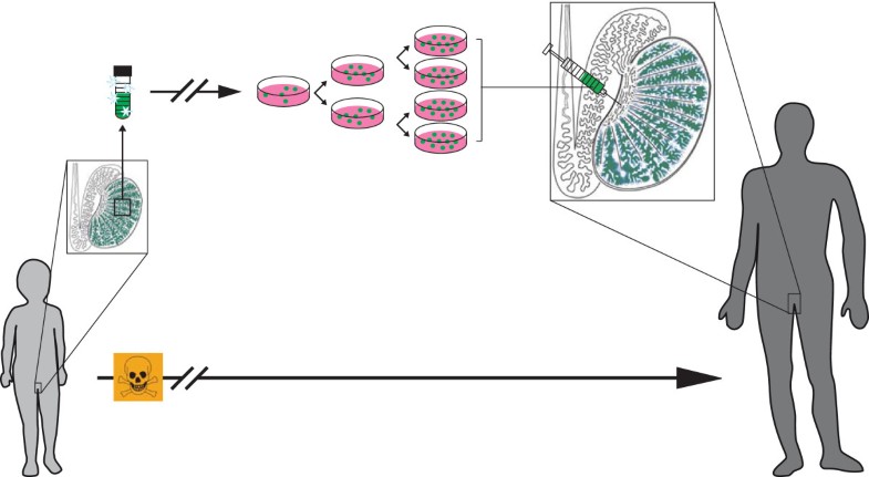stem cell treatment for shoulders stem cell treatment for shoulders