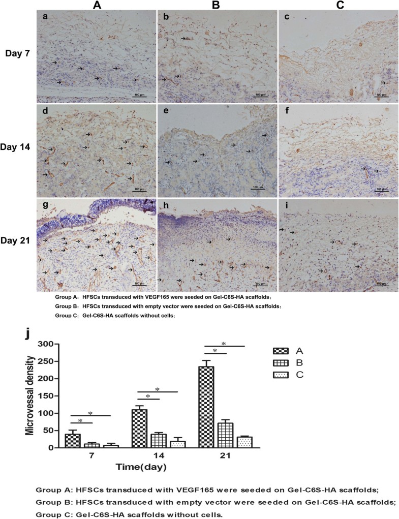Gelatinchondroitin6sulfatehyaluronic acid scaffold seeded with