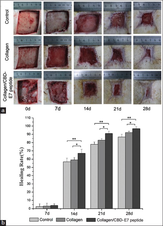 Acceleration of wound healing in acute fullthickness skin wounds using