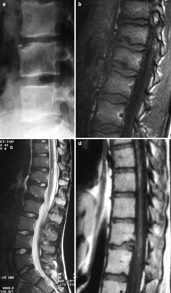 Spine Springerlink