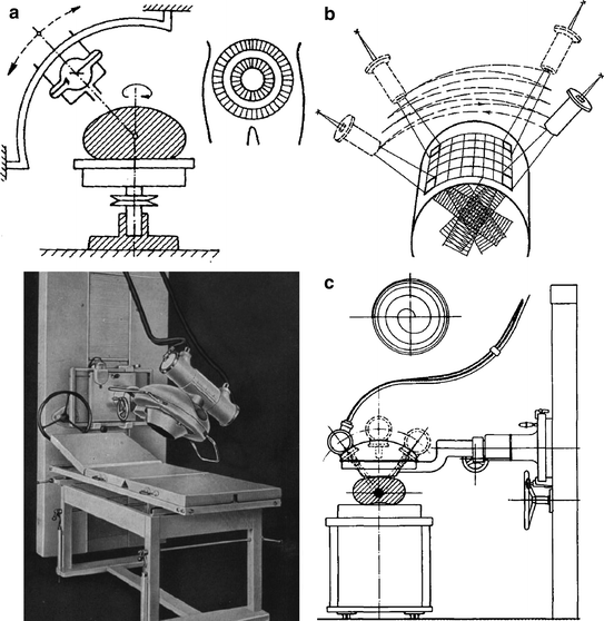 Historical Development of Stereotactic Ablative Radiotherapy ...