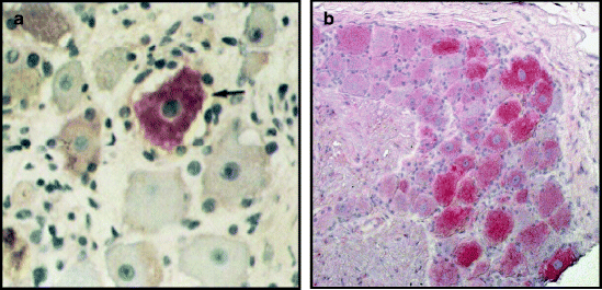 Simian Varicella Virus Pathogenesis | SpringerLink