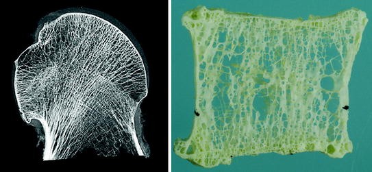 Characterisation Of Trabecular Bone Structure Springerlink