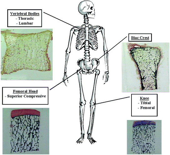 Characterisation of Trabecular Bone Structure | SpringerLink