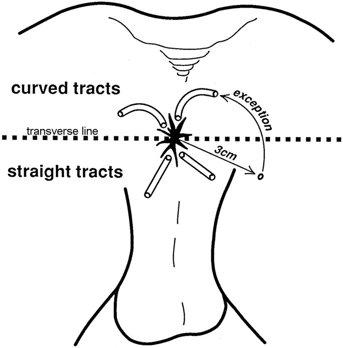 Benign Anorectal Abscess And Fistula Springerlink