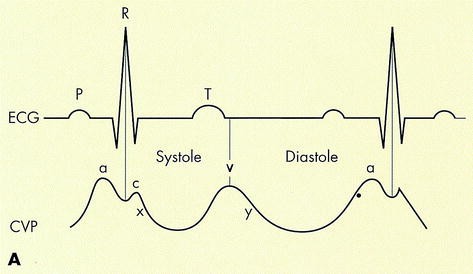 EKG hipertónia feltárására