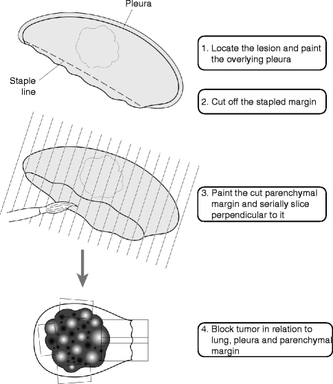 Lung Springerlink - 