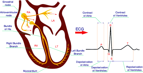 An Introduction to ECG Signal Processing and Analysis | SpringerLink