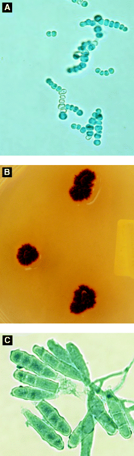 Infectious Diseases Springerlink