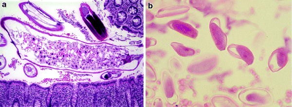 a pinworms vermacar ból széles spektrumú gyógyszerek paraziták ellen