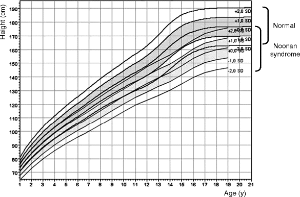 Noonan Syndrome Growth Chart