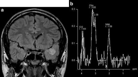 Magnetic Resonance Spectroscopy In Epilepsy Springerlink