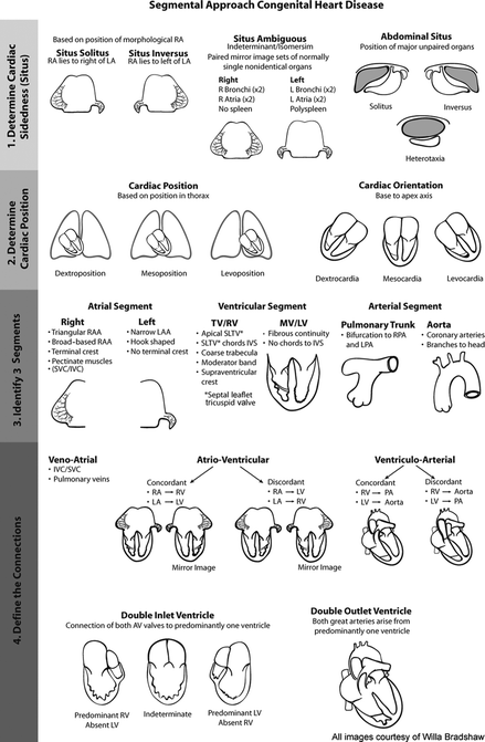Congenital Heart Disease | SpringerLink