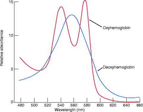 Polidocanol Dilution Chart