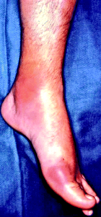 kimono judo mizuno trançado