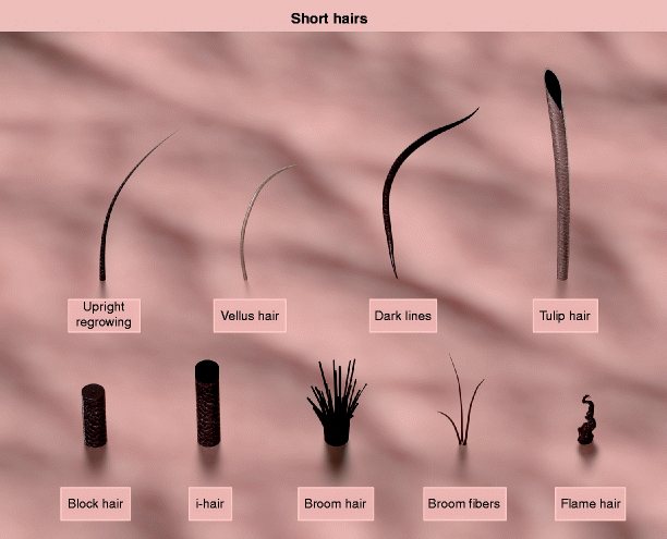 Hair Shafts Springerlink