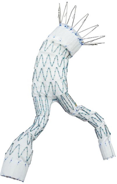 Endovascular Management Of Aortic Aneurysmal And Stenotic Disease Springerlink Endovascular Management Of Aortic Aneurysmal And Stenotic Disease Springerlink