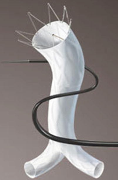 Endovascular Management Of Aortic Aneurysmal And Stenotic Disease Springerlink Endovascular Management Of Aortic Aneurysmal And Stenotic Disease Springerlink