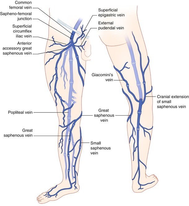 Venous Thromboembolic Disease Springerlink