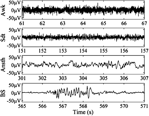 Eeg Signal Processing Theory And Applications Springerlink - 