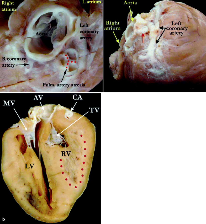 Cardiovascular System | SpringerLink Cardiovascular System | SpringerLink