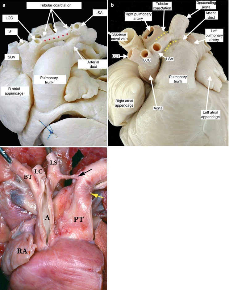 Cardiovascular System | SpringerLink Cardiovascular System | SpringerLink