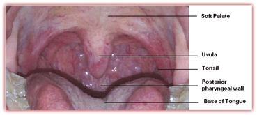 papillomavírus uvula)