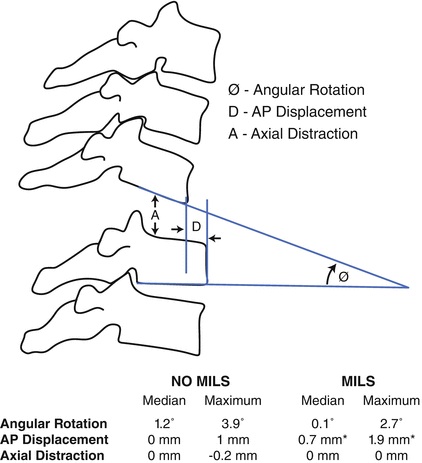 Airway Management In Trauma Springerlink