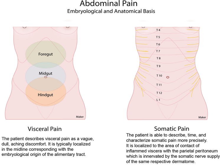 Abdominal Pain SpringerLink
