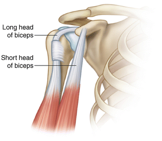 Disorders of the Long Head of the Biceps Tendon | SpringerLink