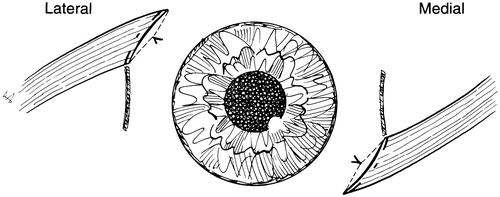 A And V Pattern Strabismus Springerlink