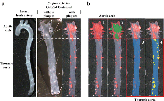 Oil Red O And Hematoxylin And Eosin Staining For Quantification Of Atherosclerosis Burden In Mouse Aorta And Aortic Root Springerlink