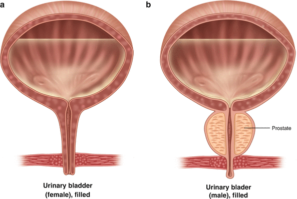 The Neurogenic Bladder And Hypertonic Pelvic Floor Muscle