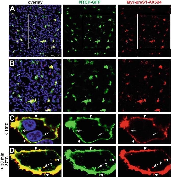 Live Cell Imaging Confocal Microscopy Analysis of HBV MyrPreS1 Peptide