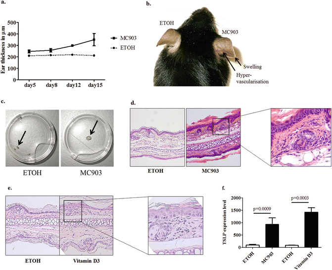 A Mouse Model for Atopic Dermatitis Using Topical Application of