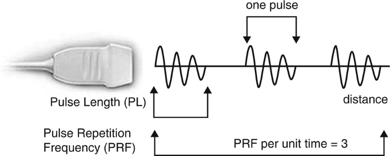 Basics of Ultrasound: Pitfalls and Limitations | SpringerLink