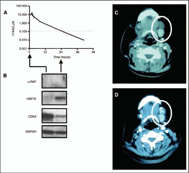 Emerging Molecular Therapies Drugs Interfering With Signal - 