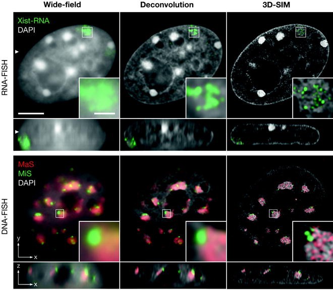 Fluorescence In Situ Hybridization Applications for SuperResolution 3D