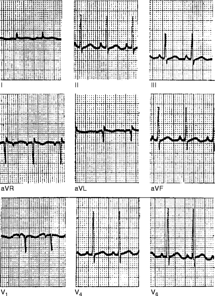 The Mammalian Electrocardiogram Comparative Features Springerlink