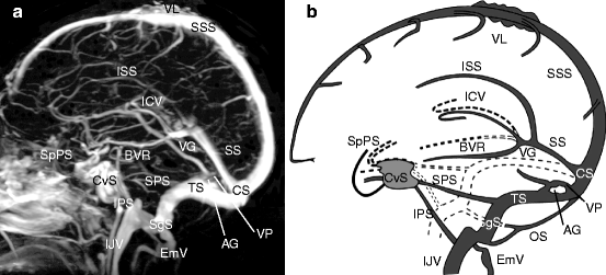 Normal Anatomy Of Intracranial Veins Demonstration With Mr Angiography 3d Ct Angiography And Microangiographic Injection Study Springerlink Normal Anatomy Of Intracranial Veins Demonstration With Mr Angiography 3d Ct Angiography And Microangiographic Injection Study Springerlink