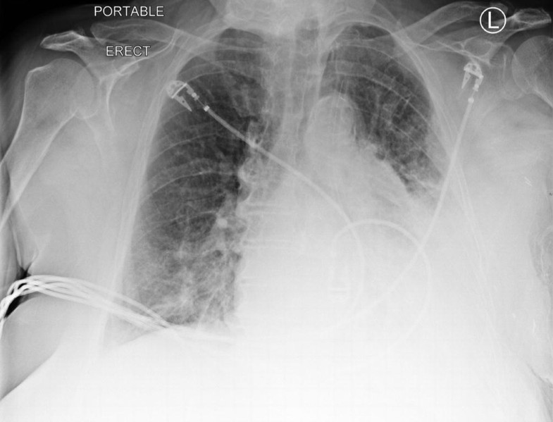 Fig. 28.12