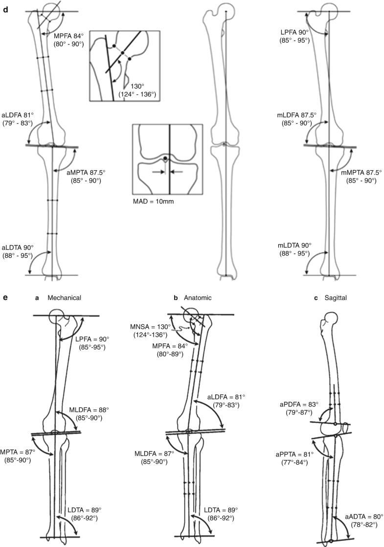 Developmental Disorders Of The Knee Springerlink Developmental Disorders Of The Knee Springerlink