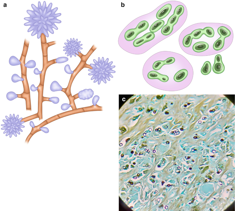 Fig. 6.4