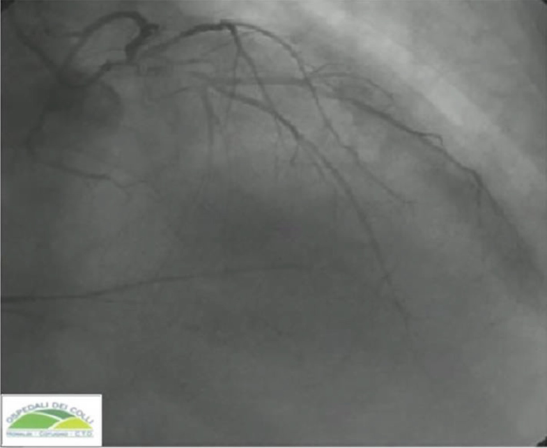 Fig. 9.8d