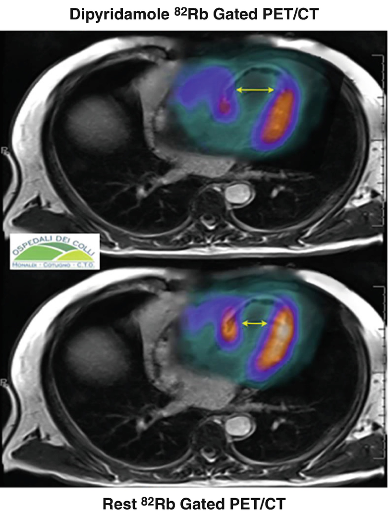 Fig. 9.10d