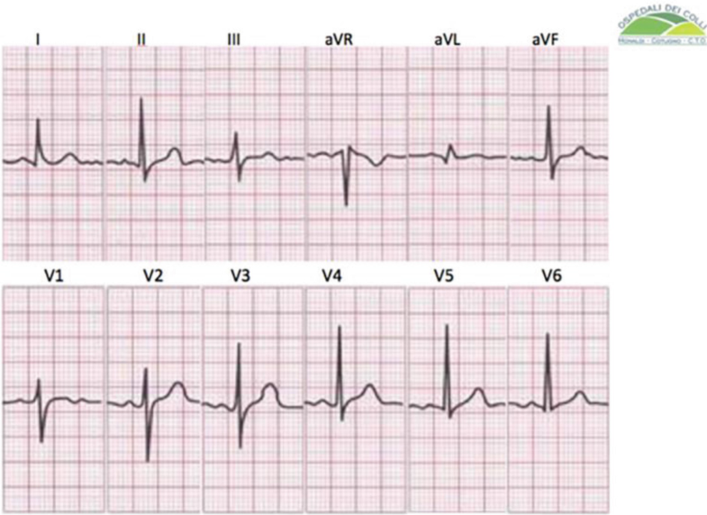 Fig. 9.11a