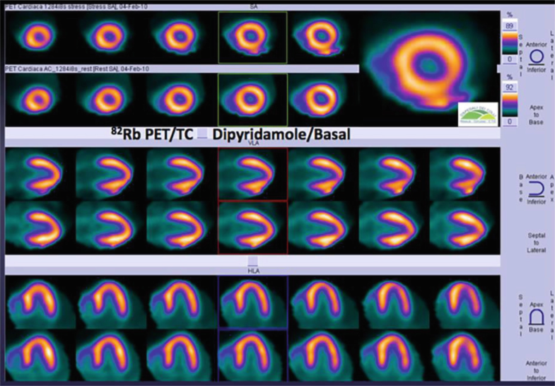 Fig. 9.11b